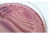 La resistenza alla colistina in Escherichia coli