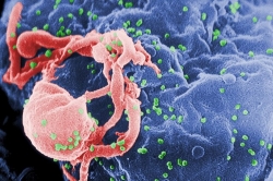 HIV, un vaccino mosaico dai risultati promettenti