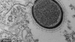 Siberia. Ritrovato un antico virus gigante congelato: sarà riportato in vita?